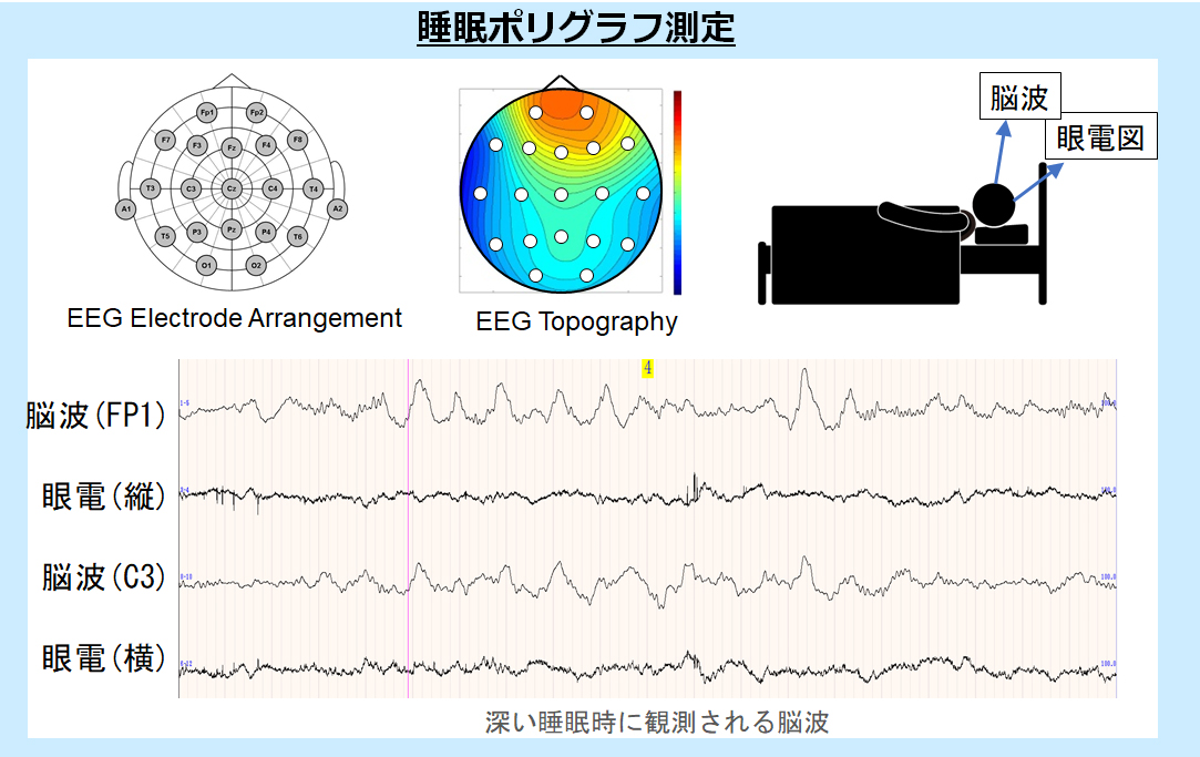 睡眠中の被験者から測定した生体信号(脳波と眼電図)